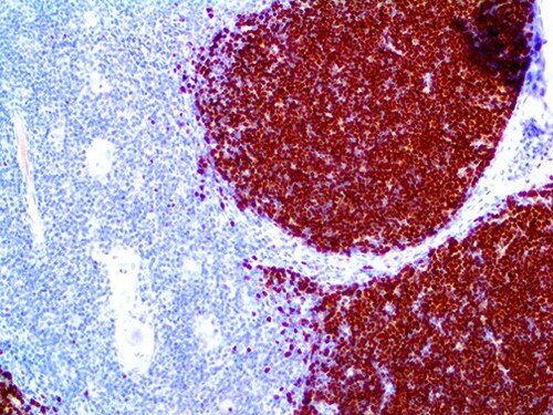 IHC of TdT on an FFPE Thymus Tissue